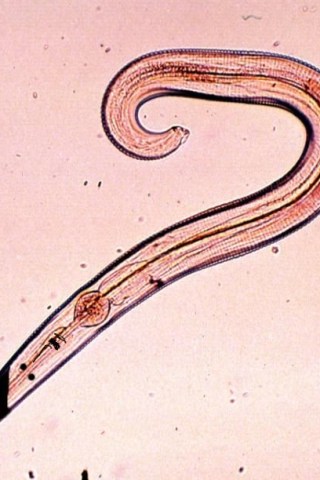 A Pinworm Named Hitler