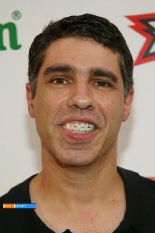 Baba Booey's Lip-Ectomy