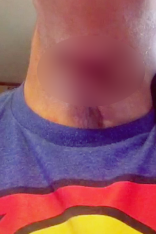 Jeff the Drunk Got His Lump Hacked Off