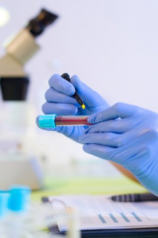 New Blood Test May Predict Your Eventual Death