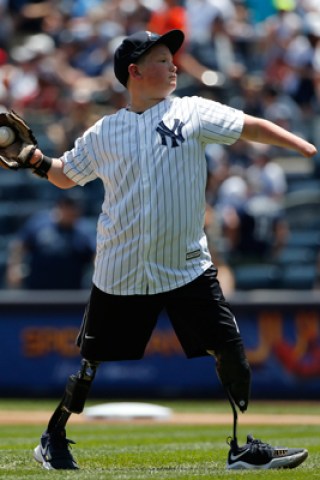 Boy Without Hands or Legs Throws Great 1st Pitch